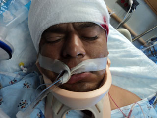 J. Doe was beaten in a shopping center parking lot early Saturday morning. Photo courtesy of Fox 29.